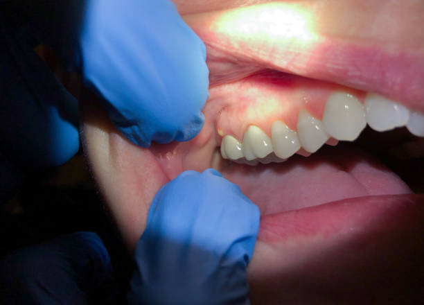 Best Weekend Emergency Dentist in University City, MO
