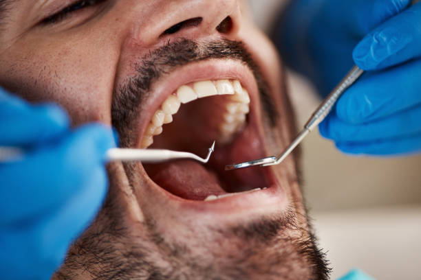 Best Weekend Emergency Dentist in University City, MO